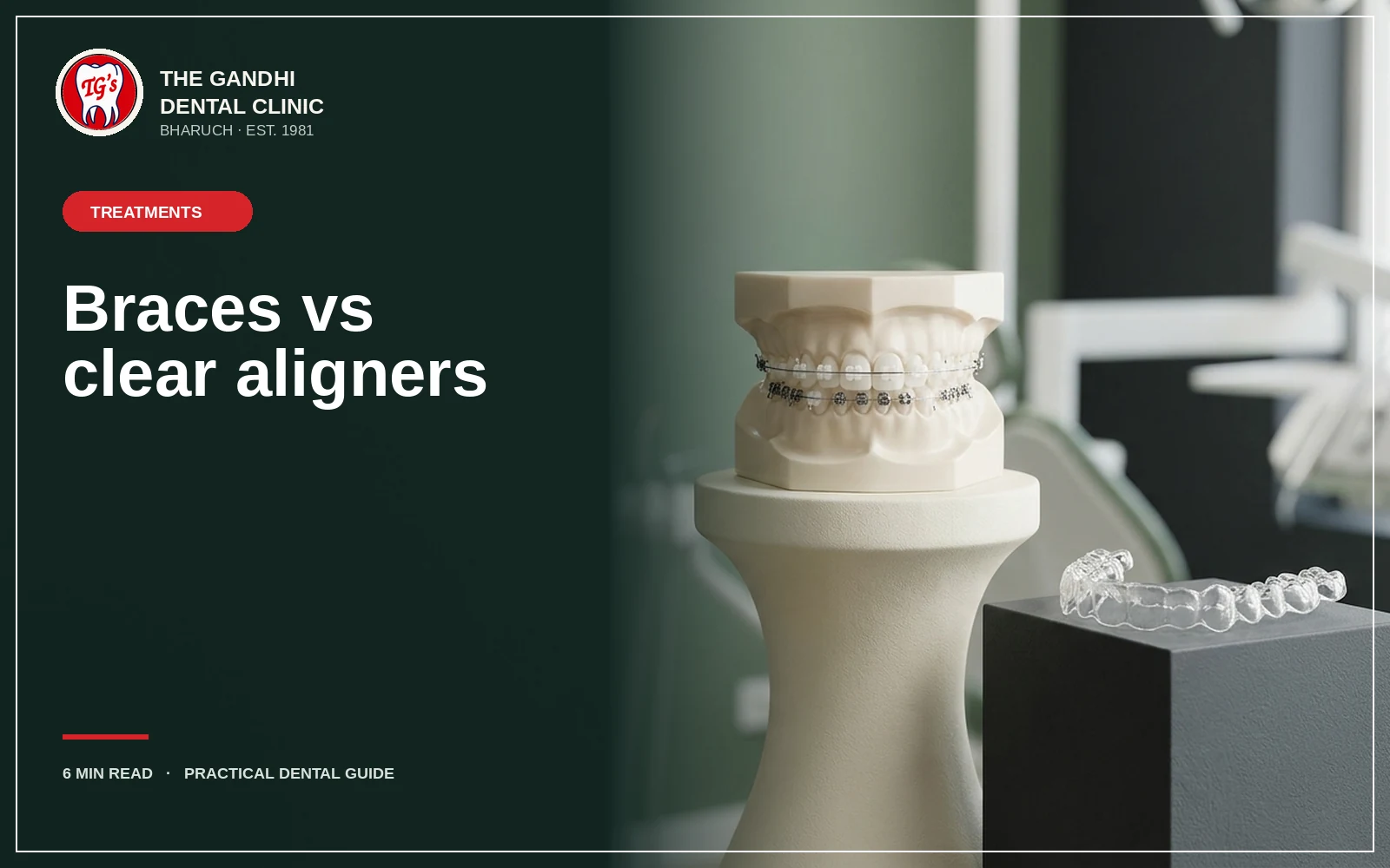 Braces or clear aligners? An honest comparison