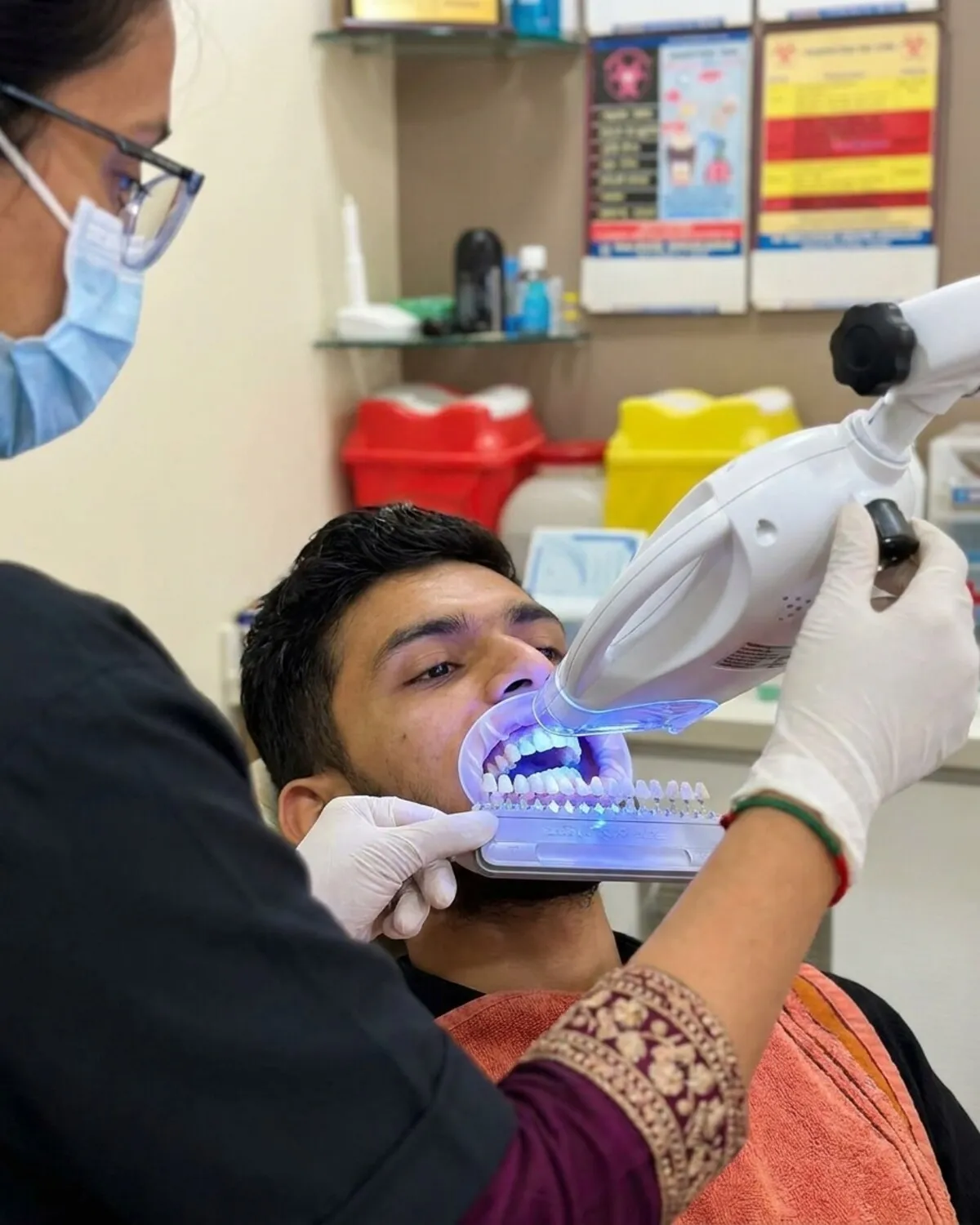 Teeth whitening at Gandhi Dental Clinic, Bharuch